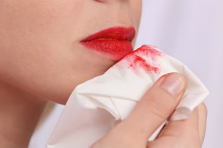 How to Stop Bleeding Lips | Causes and DIY methods